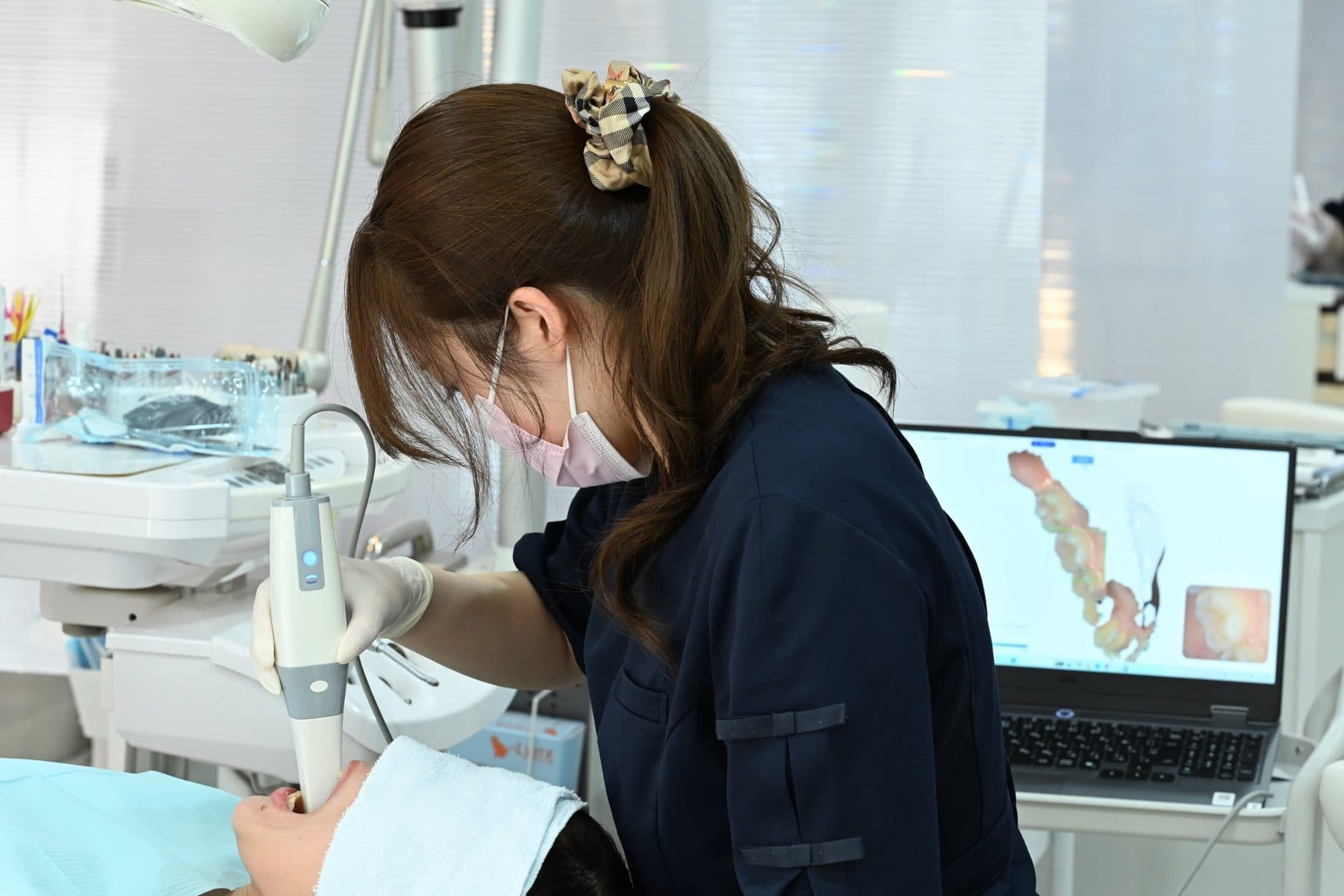 口腔内スキャナーで歯型を取る様子