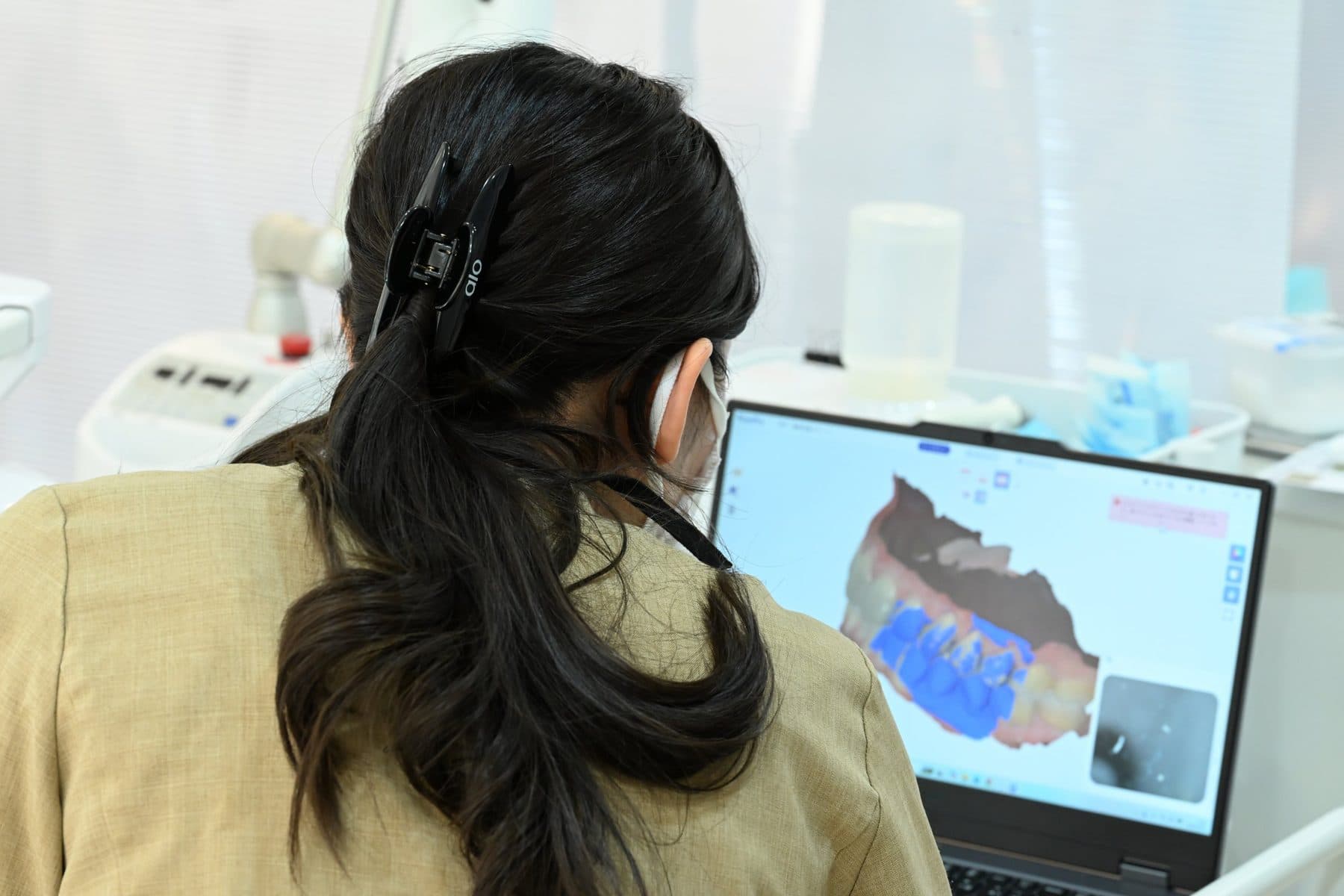 歯の3Dデータを確認する歯科医師