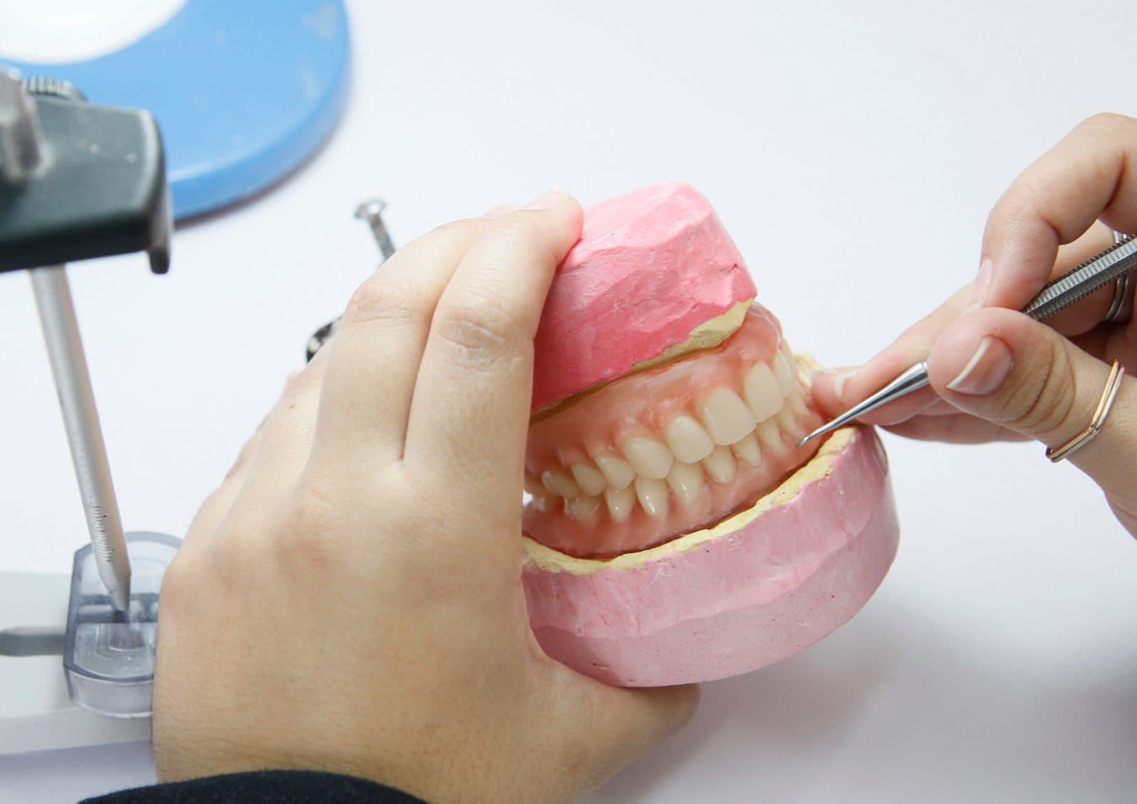 ろう義歯で形と噛み合わせを確認する工程